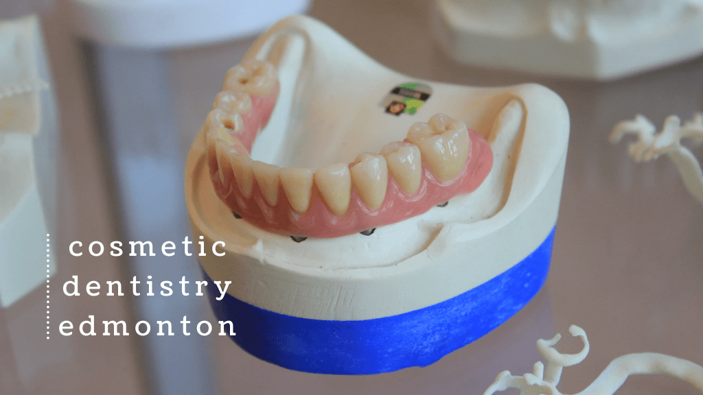Best Cosmetic Dentistry in Edmonton