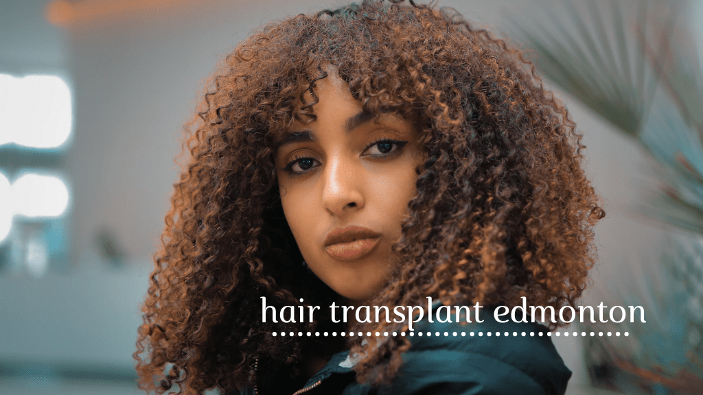Best Hair Transplant in Edmonton