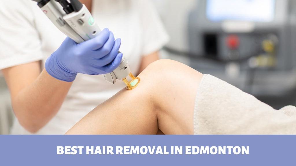 Best Hair Removal in Edmonton