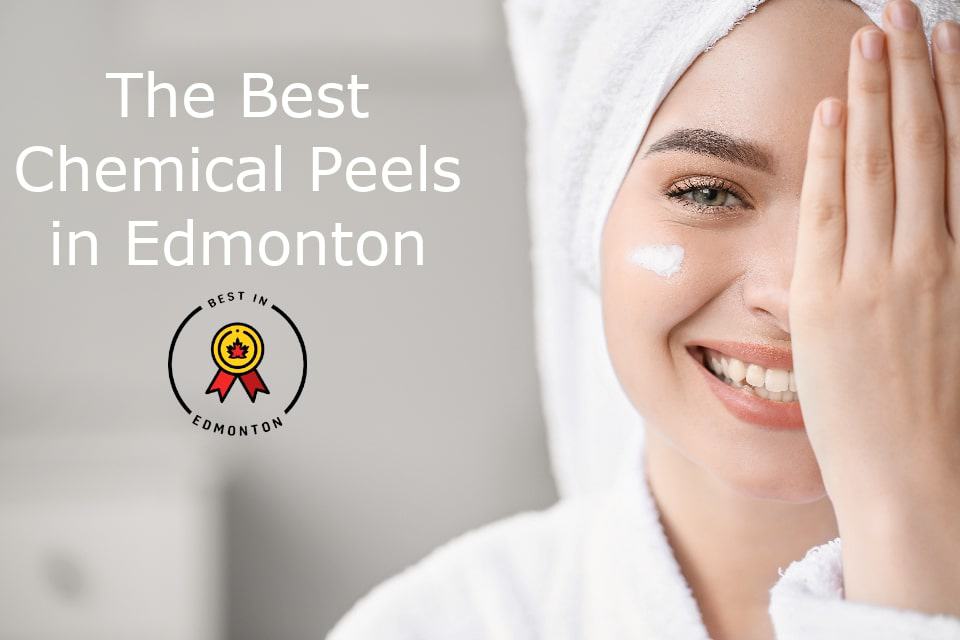 Best Chemical Peel in Edmonton
