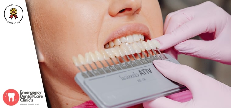 Emergency Dentist North-West