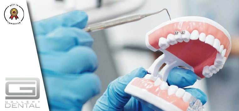 Gallery Dental - Dr. Harbuksh Sekhon