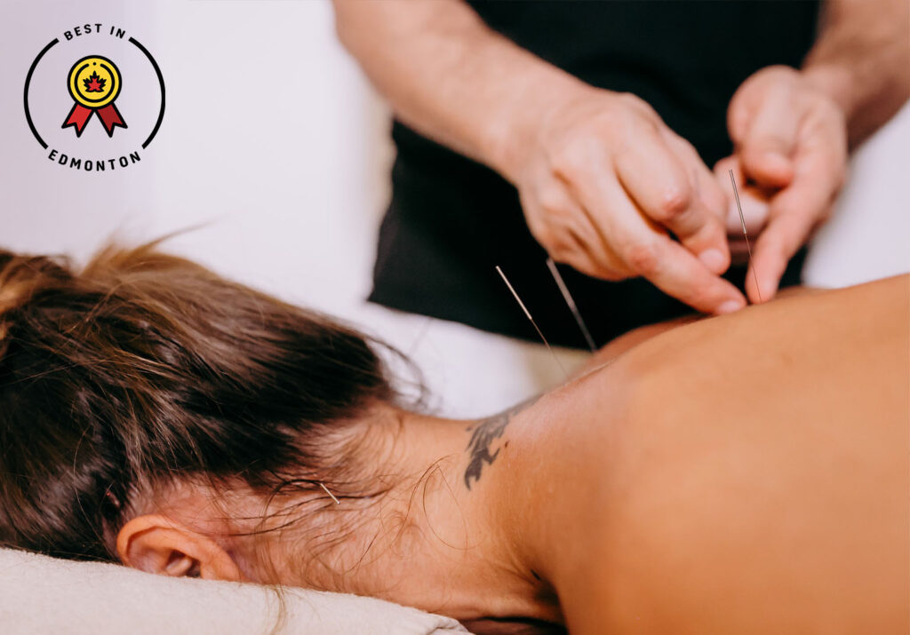 TOP 5 ACUPUNCTURE CLINICS IN EDMONTON
