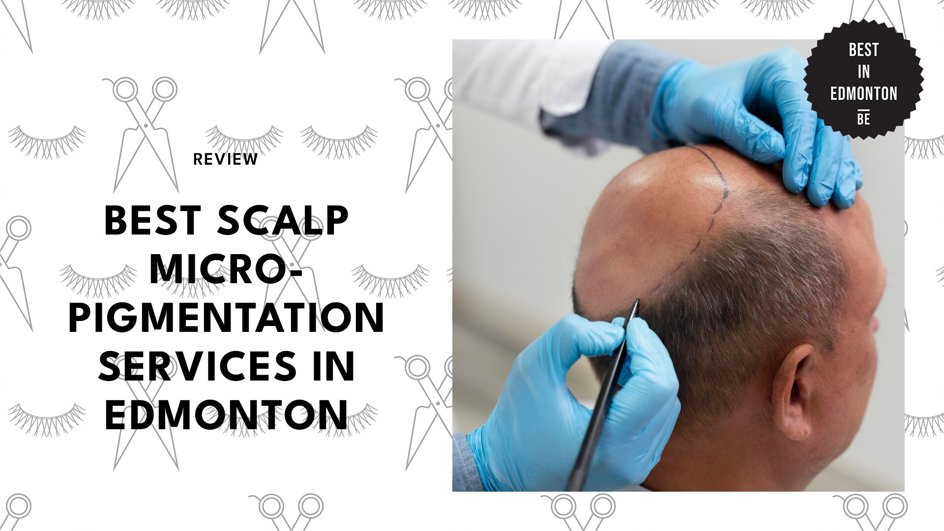 best-scalp-micropigmentation-in-edmonton