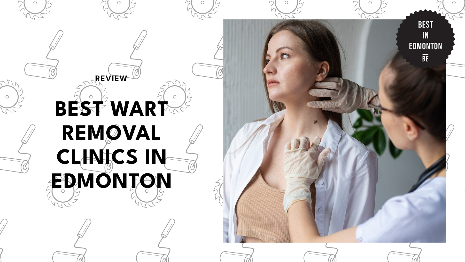 best-wart-removal-edmonton