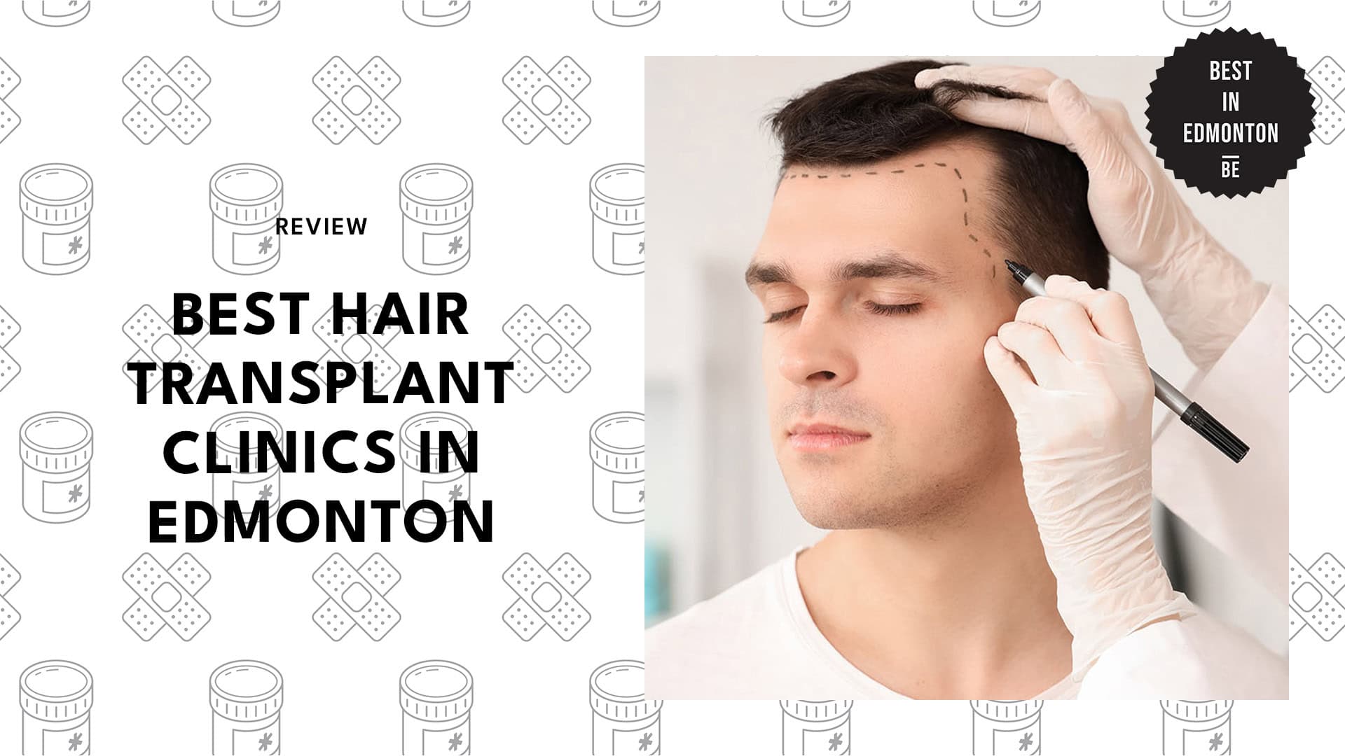 hair-transplant-edmonton