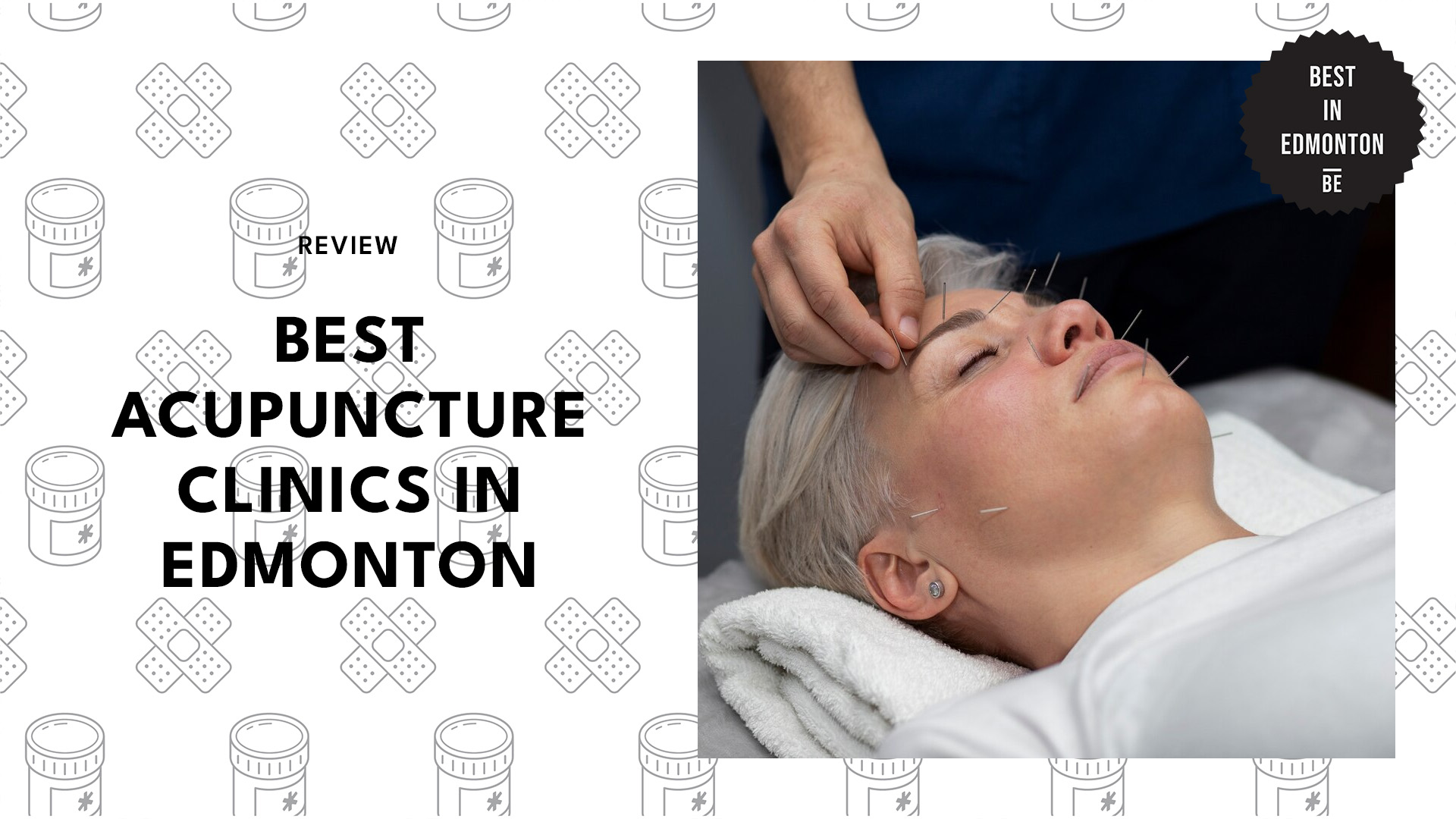 best-acupuncture-clinics-edmonton